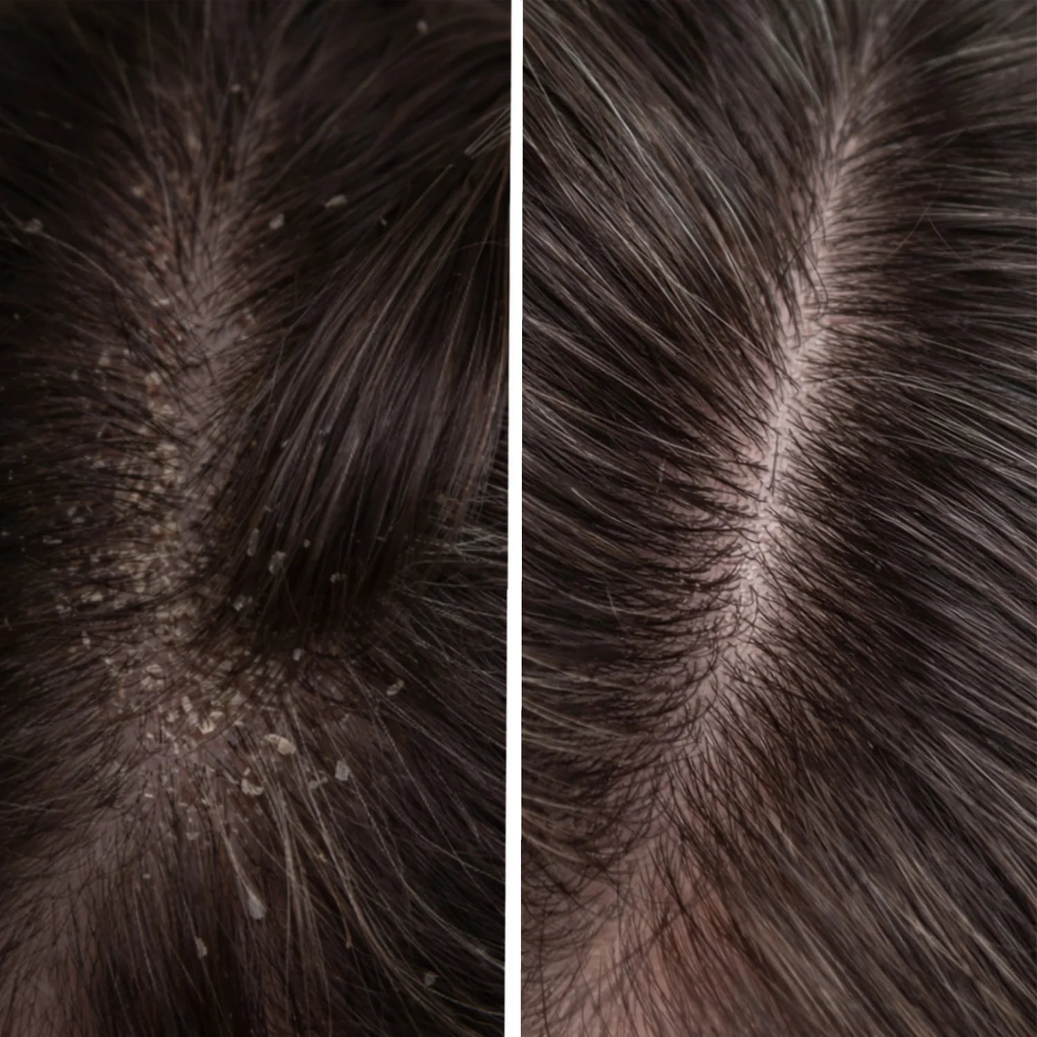 Scalp scrub